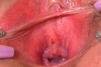 Gape My Pussy Porn Pictures s2